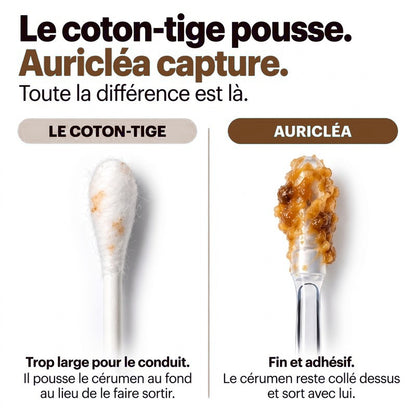 Le coton-tige pousse, Auricléa™ capture